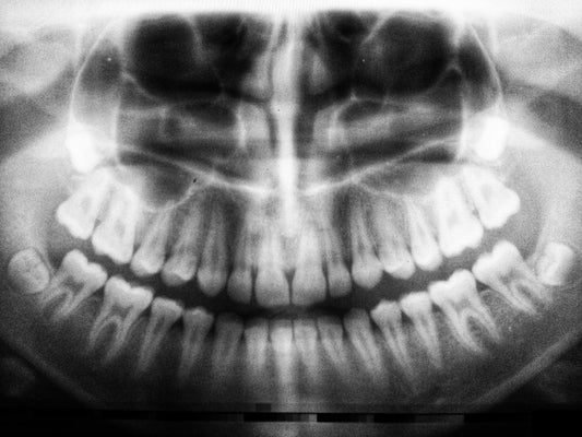 Is Sucralose Bad For Your Teeth?