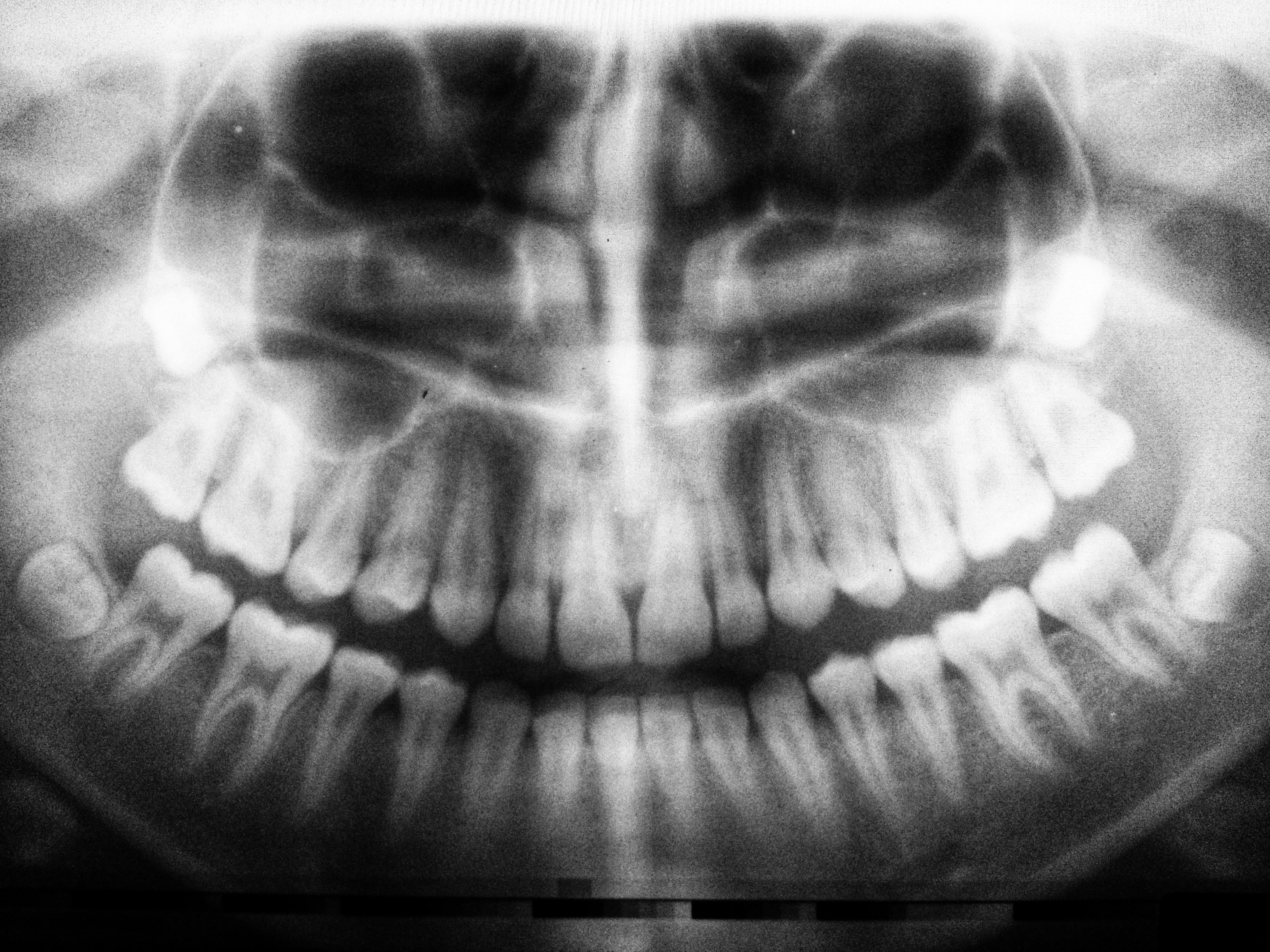 Is Sucralose Bad For Your Teeth?